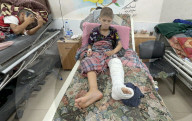 Wounded Gaza children in hospital