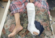 Wounded Gaza children in hospital