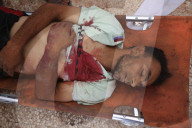 Body of martyr Khalil Azzam in hospital
