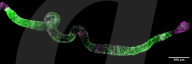 Fruit fly regeneration clues to helping extend human lifespan