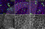 Fruit fly regeneration clues to helping extend human lifespan
