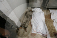 Injured Gazans arrive hospital after Israeli attack
