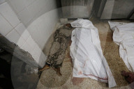 Injured Gazans arrive hospital after Israeli attack