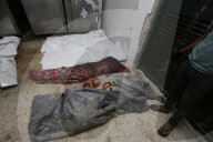 Injured Gazans arrive hospital after Israeli attack