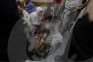 Injured Gazans arrive hospital after Israeli attack