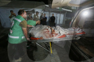 Injured Gazans arrive hospital after Israeli attack