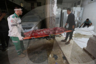 Injured Gazans arrive hospital after Israeli attack