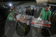 Injured Gazans arrive hospital after Israeli attack