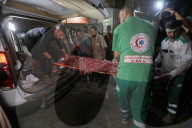 Injured Gazans arrive hospital after Israeli attack