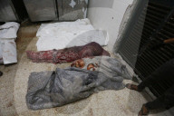 Injured Gazans arrive hospital after Israeli attack