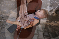 Gaza baby dies due to lack of medical care
