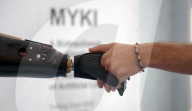 Prosthetic hand controlled by implanted magnets 