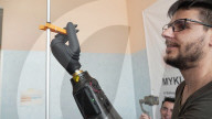 Prosthetic hand controlled by implanted magnets 