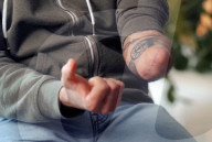 Prosthetic hand controlled by implanted magnets 