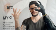 Prosthetic hand controlled by implanted magnets 