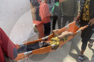 Wounded Palestinians arrive hospital