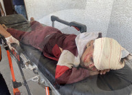 Wounded Palestinians arrive hospital