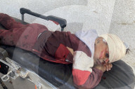 Wounded Palestinians arrive hospital