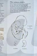Anti-abortion activists set up outside clinic ‘safe zones’ on first day of new law in England