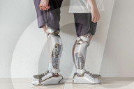 Prosthetic limb for child amputees grows as they do