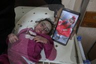 Palestinian girl diagnosed with rare skin disease