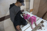 Palestinian girl diagnosed with rare skin disease