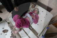 Palestinian girl diagnosed with rare skin disease