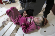 Palestinian girl diagnosed with rare skin disease