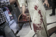 Civilians caught in crossfire of Syrian civil war