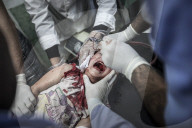 Civilians caught in crossfire of Syrian civil war