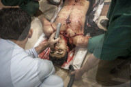 Syrian civil war horror