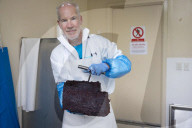 Dissecting the world's rarest whale
