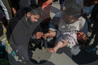 Leech Therapy On Nowruz Day In Kashmir