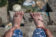 Leech Therapy On Nowruz Day In Kashmir