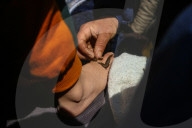 Leech Therapy On Nowruz Day In Kashmir