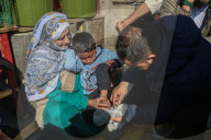 Leech Therapy On Nowruz Day In Kashmir
