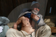 Leech Therapy On Nowruz Day In Kashmir