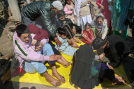Leech Therapy On Nowruz Day In Kashmir