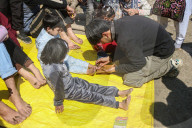 Leech Therapy On Nowruz Day In Kashmir