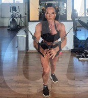 SCHICKSALE - Diagnose Dickdarmkrebs: Bodybuilderin Ann-Sofie Byberg aus Schweden musste sich einer Stoma-OP unterziehen