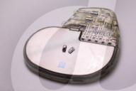 World's smallest heart pacemaker