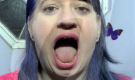 Woman with widest mouth gape