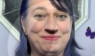Woman with widest mouth gape