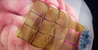Minimally invasive brain implant gets regulatory clearance