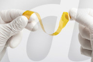 Minimally invasive brain implant gets regulatory clearance