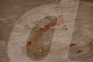 15-year-old Boy Slashed To The Arm And Wrist At The West Farms Sq-East Tremont Avenue Train Station In West Farms Bronx New York