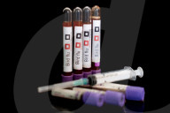 Bird Flu (Avian Influenza) Stock Photos