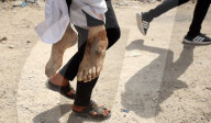 Palestinians Killed In Fresh Israeli Strikes In Gaza 