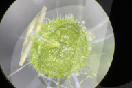 Vegetables of the future could be fortified using tiny needles
