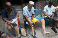 Artificial Limb Fitment Camp In Dhaka, Bangladesh